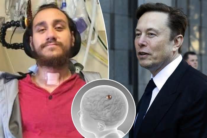 How Elon Musk’s Neuralink brain chip allows paralyzed people to control devices with their mind