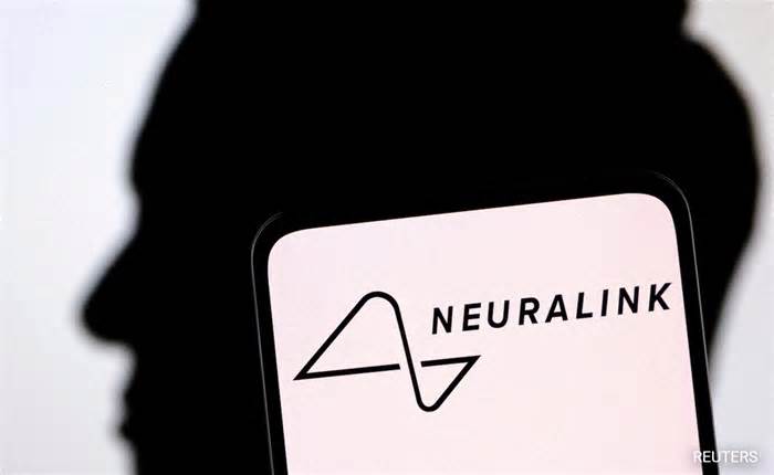 Elon Musk's Neuralink Says Issue In Brain Implant Fixed
